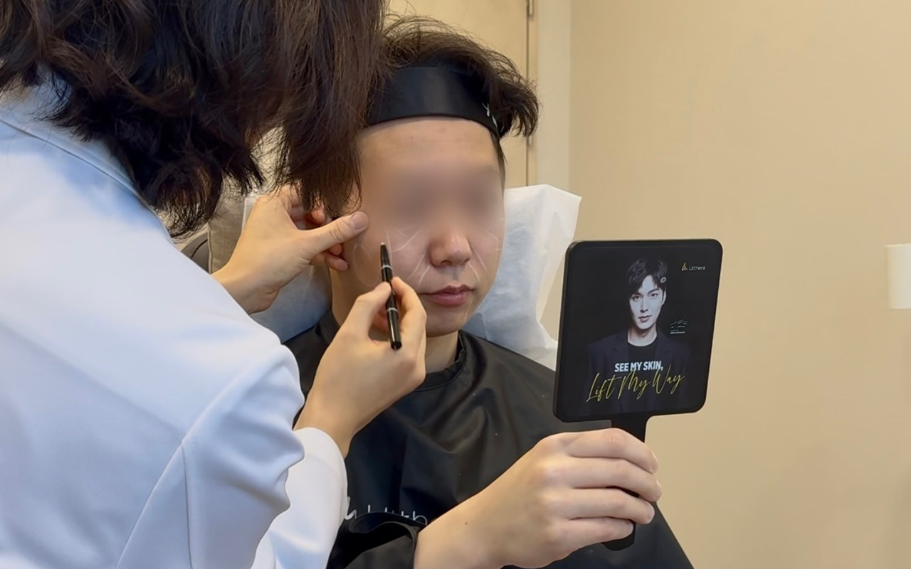 필러
